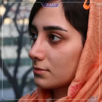 نمونه عمل جراحی بینی دکتر محمد مجیدی — تصویر 9
