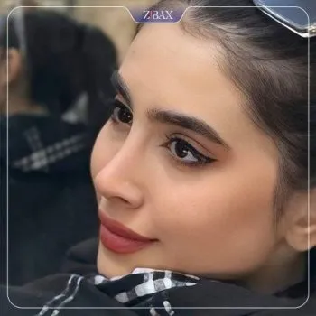 نمونه عمل جراحی بینی دکتر محمد مجیدی — تصویر 4