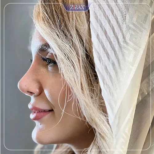 نمونه عمل جراحی بینی دکتر اسدالله مهدوی — تصویر 6