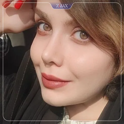 نمونه عمل جراحی بینی دکتر مصطفی کلانی — تصویر 2
