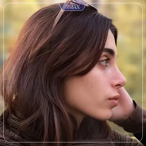 نمونه عمل جراحی بینی دکتر مصطفی کلانی — تصویر 5