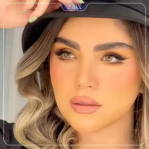 نمونه عمل جراحی بینی دکتر مصطفی کلانی — تصویر 9