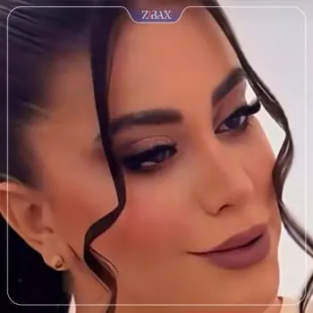 نمونه عمل جراحی بینی دکتر علیرضا کامیابی — تصویر 5