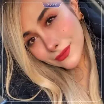 نمونه عمل جراحی بینی دکتر علیرضا کامیابی — تصویر 4