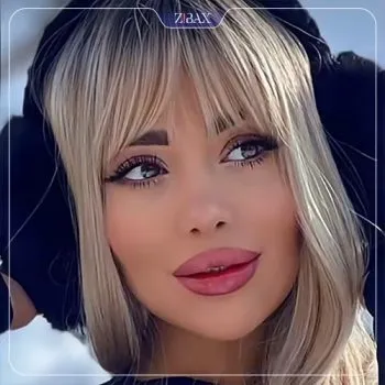 نمونه عمل جراحی بینی دکتر علیرضا کامیابی — تصویر 6