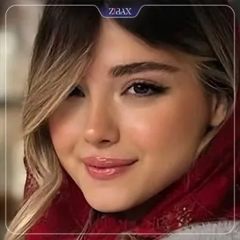 نمونه عمل جراحی بینی دکتر علیرضا کامیابی — تصویر 2