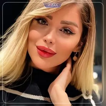 نمونه عمل جراحی بینی دکتر علیرضا کامیابی — تصویر 3
