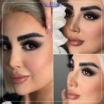 نمونه عمل جراحی بینی دکتر مهرداد نادریان — تصویر 3