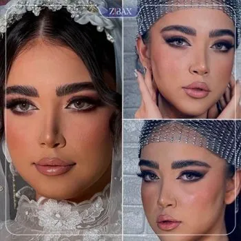 نمونه عمل جراحی بینی دکتر مهرداد نادریان — تصویر 2