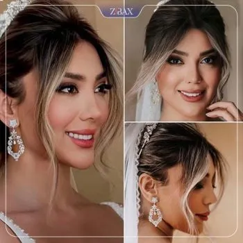 نمونه عمل جراحی بینی دکتر مهرداد نادریان — تصویر 4