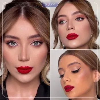 نمونه عمل جراحی بینی دکتر مهرداد نادریان — تصویر 5