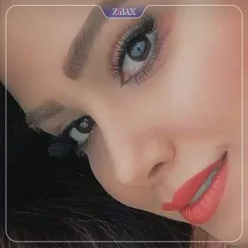 نمونه عمل جراحی بینی دکتر شاهین میلانی — تصویر 8