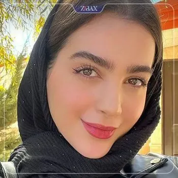 نمونه عمل جراحی بینی دکتر شاهین میلانی — تصویر 6