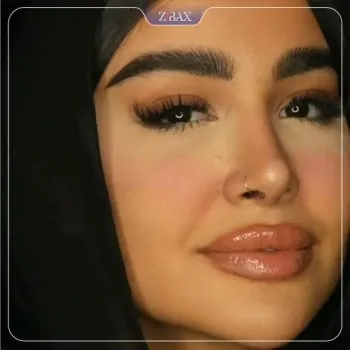نمونه عمل جراحی بینی دکتر شاهین میلانی — تصویر 5