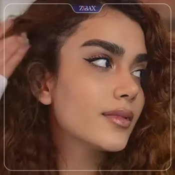 نمونه عمل جراحی بینی دکتر شاهین میلانی — تصویر 4