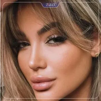 نمونه عمل جراحی بینی دکتر مجتبی ملکی — تصویر 8