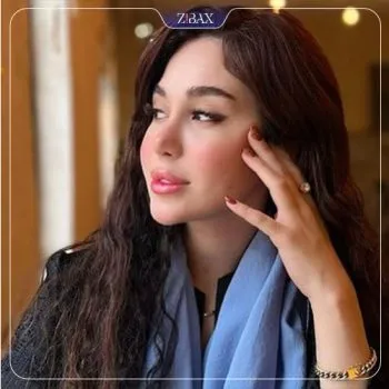 نمونه عمل جراحی بینی دکتر مجتبی ملکی — تصویر 1