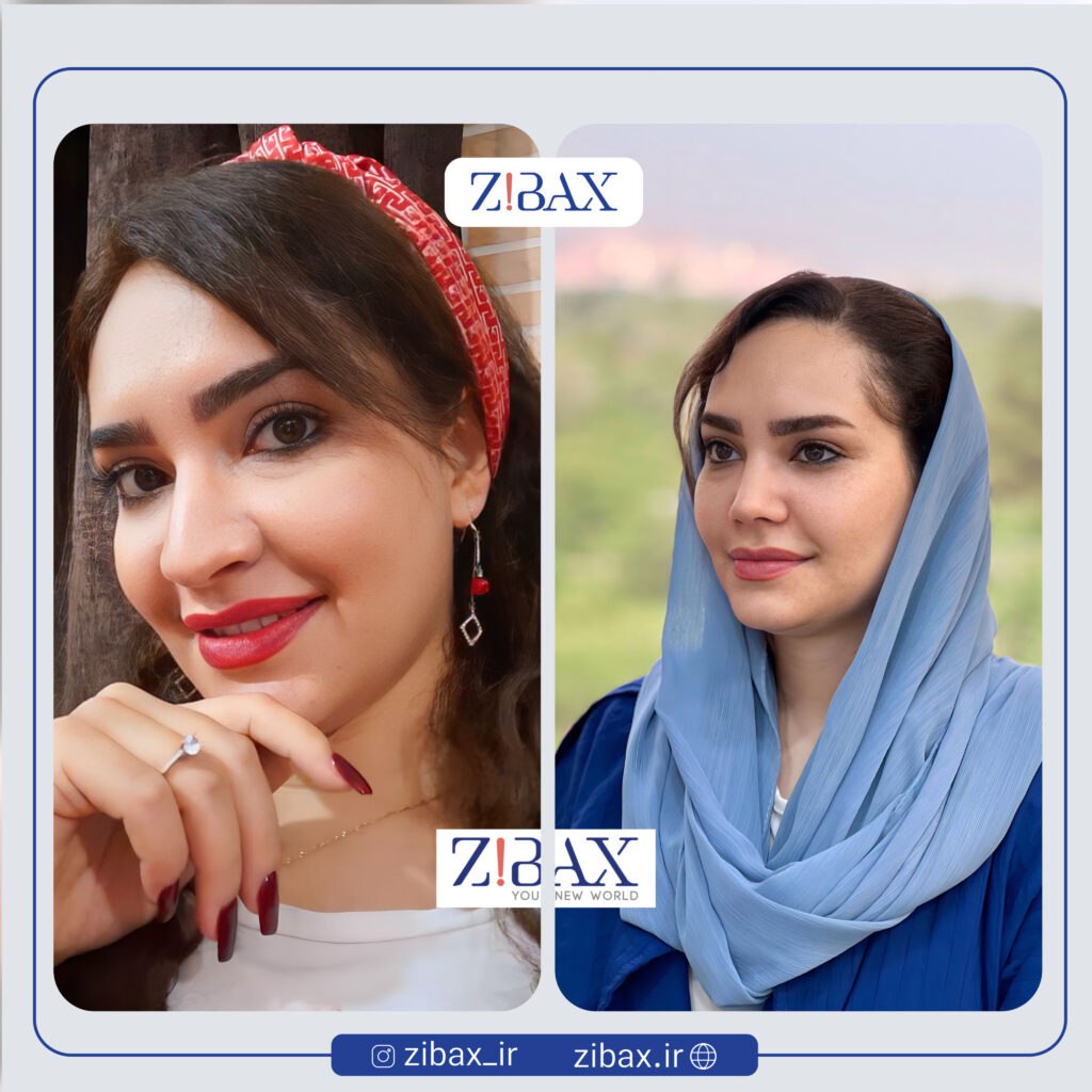 نمای کامل قبل و بعد از عمل بینی گوشتی در یک تصویر؛ تفاوت در نوک و تیغه بینی