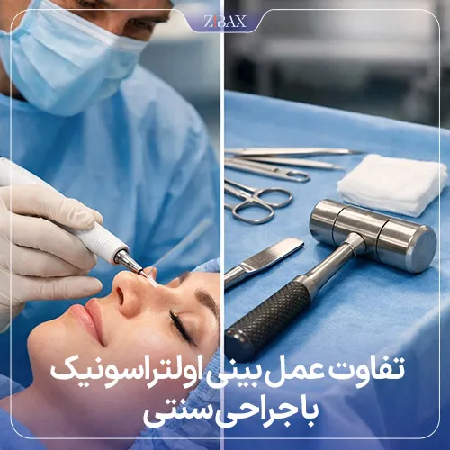 تفاوت عمل بینی با امواج فراصوت و جراحی بینی