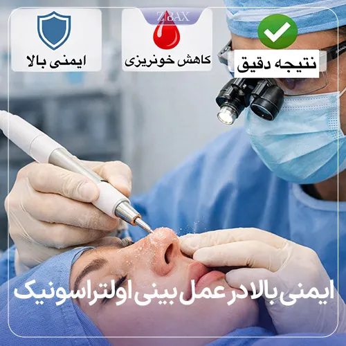 ایمنی و دقت در عمل بینی با امواج فراصوت