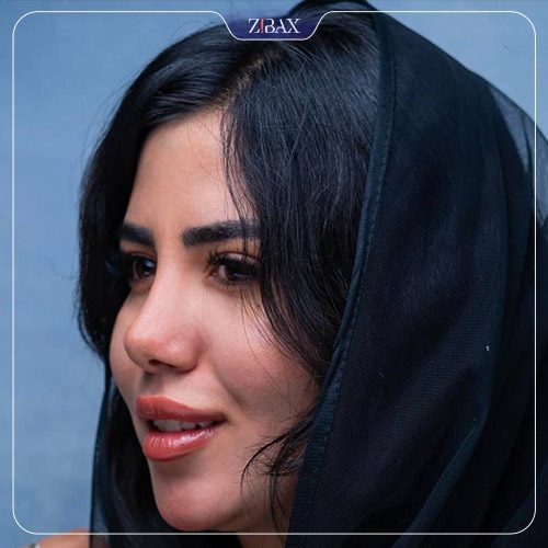 عمل بینی گوشتی خیلی بزرگ