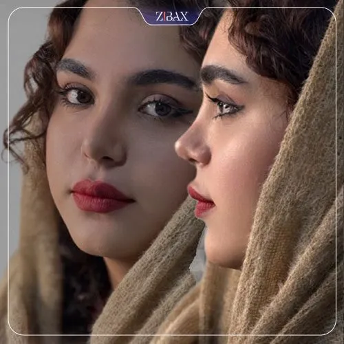 نمونه عمل جراحی بینی دکتر فرهاد محرابی سی سخت — تصویر 10