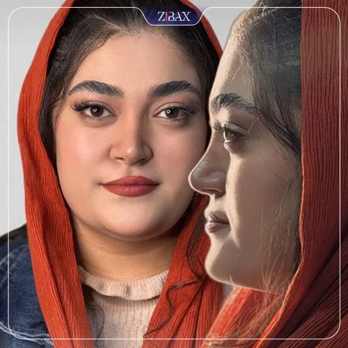 نتیجه جراحی