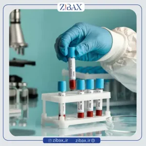 آزمایش قبل از عمل بینی