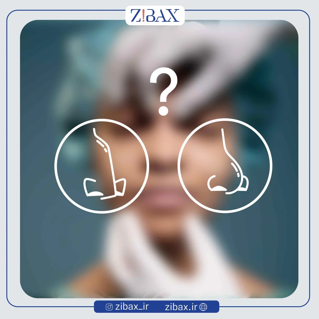 تفاوت بینی گوشتی و استخوانی