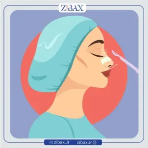 بخیه غیرجذبی بینی