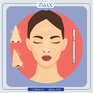 همه چیز درباره کشیدن بخیه بینی