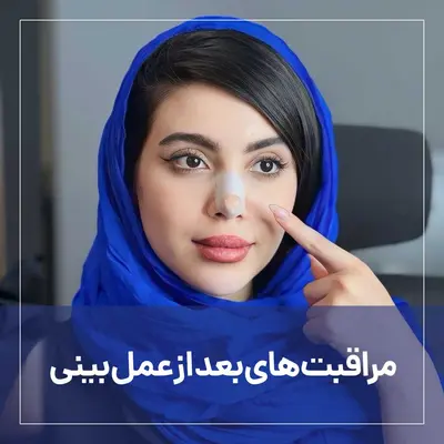 مراقبت بعد از عمل بینی