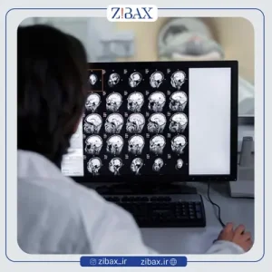 عکس پزشکی قبل از عمل بینی