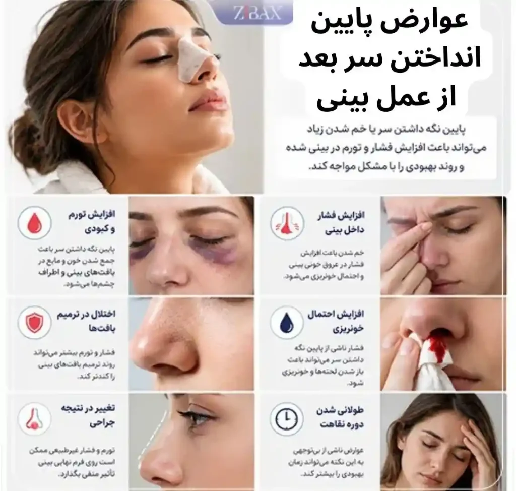 عوارض پایین گرفتن سر بعد از عمل بینی