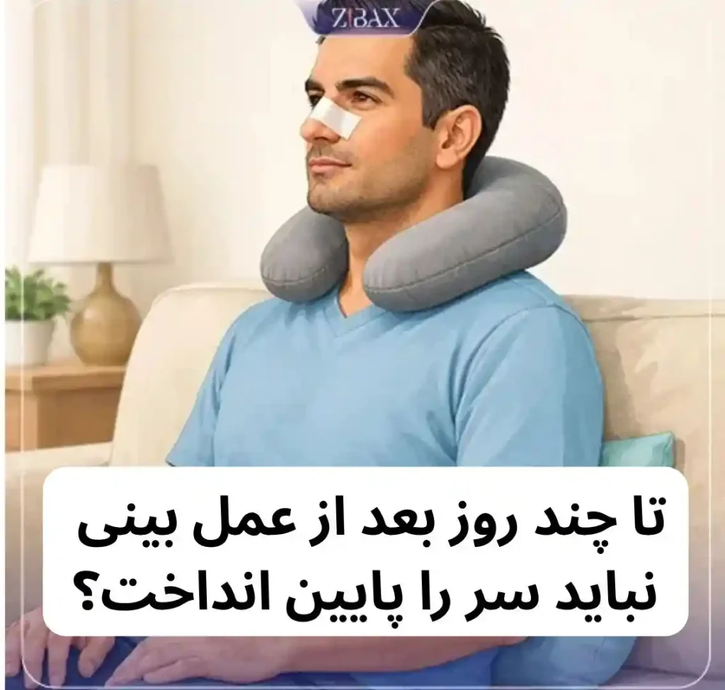 چند روز بعد از عمل بینی میتوان سر را پایین آورد؟