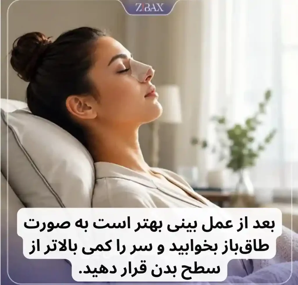 بعد از عمل بینی سر باید چگونه باشد
