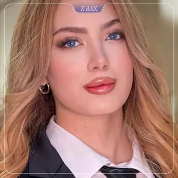نمونه عمل جراحی بینی دکتر جواد خالقی — تصویر 1