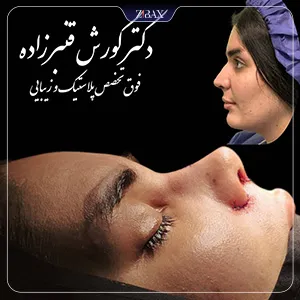 نمونه عمل جراحی بینی دکتر کورش قنبر زاده — تصویر 6