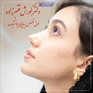 نمونه عمل جراحی بینی دکتر کورش قنبر زاده — تصویر 3