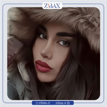 نمونه عمل بینی دکتر صفا صمدزاده در تهران