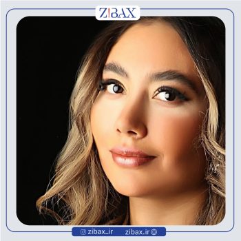 نمونه عمل بینی دکتر حامد محمدی درتهران