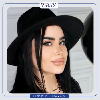 نمونه جراحی بینی با دکتر پیمان برومند در تهران