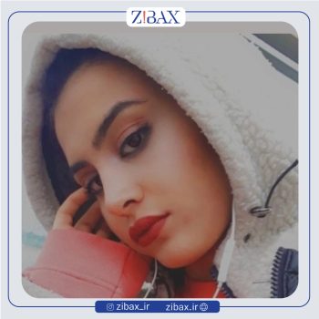 نمونه عمل بینی دکتر شروین سپنج در تهران