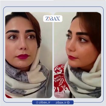 نمونه کار دکتر حمید مزارعی در تهران