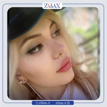 نمونه جراحی بینی دکتر رضا بدیعی در تهران