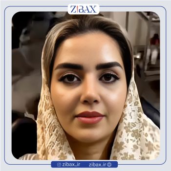 نمونه عمل بینی با دکتر بابک خسرویان