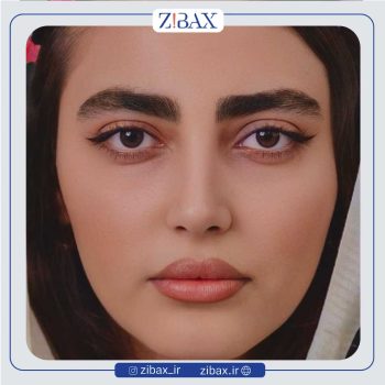 تصویر عمل زیبایی بینی با دکتر محسن بهادر در شیراز