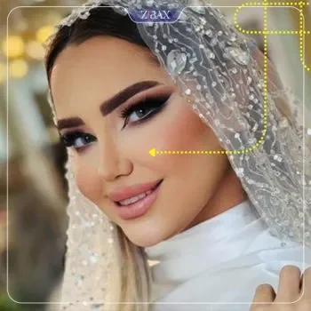 نمونه کار عمل بینی دکتر امیرحسین محمدی مفرد