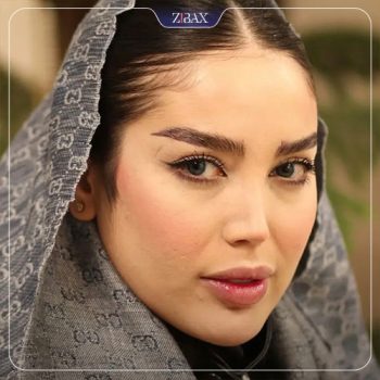 نمونه جراحی بینی با دکتر احسان شفیعی در تهران