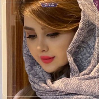 جراحی بینی توسط دکتر احسان شفیعی در تهران